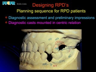 Design Session Rpd 6.rpd design philosophies | PPT