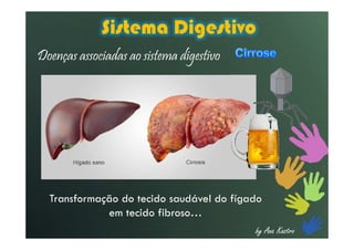 by Ana Kastro
Sistema Digestivo
Doenças associadas ao sistema digestivo
Transformação do tecido saudável do fígado
em tecido fibroso…
 