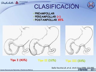 CLASIFICACIÓN
               PREAMPOLLAR
               PERIAMPOLLAR (>)
               POSTAMPOLLAR 85%




Tipo I (43%)     Tipo II (12%)           Tipo III (33%)

                          Dalla Vecchia LK, et al. Arch Surg 1998; 133:490.
 