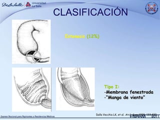 CLASIFICACIÓN

  Estenosis (12%)




                     Tipo I:
                     -Membrana fenestrada
                     -“Manga de viento”


               Dalla Vecchia LK, et al. Arch Surg 1998; 133:490.
 