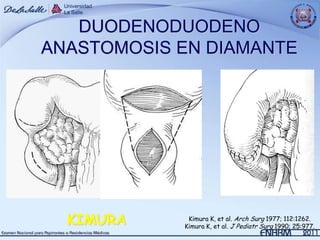 DUODENODUODENO
ANASTOMOSIS EN DIAMANTE




  KIMURA     Kimura K, et al. Arch Surg 1977; 112:1262.
            Kimura K, et al. J Pediatr Surg 1990; 25:977.
 