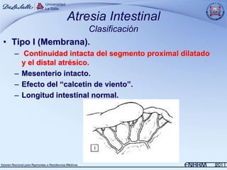 Atresia Intestinal
                   Clasificación
• Tipo I (Membrana).
  – Continuidad intacta del segmento proximal dilatado
    y el distal atrésico.
  – Mesenterio intacto.
  – Efecto del “calcetin de viento”.
  – Longitud intestinal normal.
 