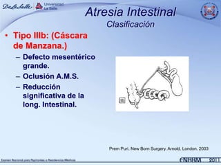 Atresia Intestinal
                          Clasificación
• Tipo IIIb: (Cáscara
  de Manzana.)
  – Defecto mesentérico
    grande.
  – Oclusión A.M.S.
  – Reducción
    significativa de la
    long. Intestinal.




                          Prem Puri. New Born Surgery. Arnold. London. 2003
 