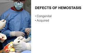 DEFECTS OF HEMOSTASIS
• Congenital
• Acquired
 