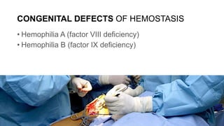 CONGENITAL DEFECTS OF HEMOSTASIS
• Hemophilia A (factor VIII deficiency)
• Hemophilia B (factor IX deficiency)
 