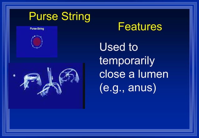 SUTURE PATTERNS.ppt