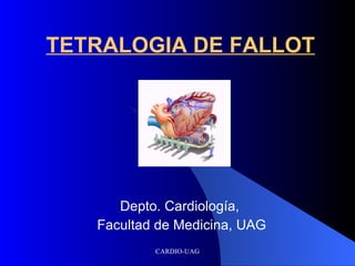 TETRALOGIA DE FALLOT Depto. Cardiología,  Facultad de Medicina, UAG 