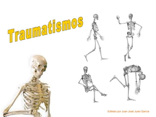 Traumatismos Editado por Juan José Justo García  