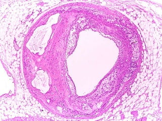 Jesús A. Custodio Marroquín 