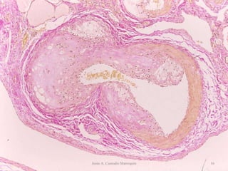 Jesús A. Custodio Marroquín 