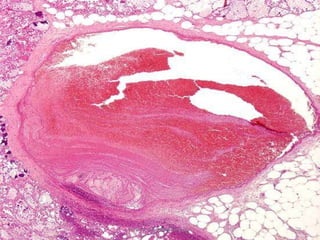 Jesús A. Custodio Marroquín 