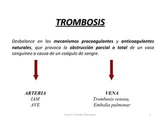 TROMBOSIS Desbalance en los  mecanismos procoagulantes  y  anticoagulantes naturales , que provoca la  obstrucción parcial o total  de un vaso sanguíneo a causa de un coágulo de sangre. VENA Trombosis venosa,  Embolia pulmonar ARTERIA  IAM  AVE Jesús A. Custodio Marroquín 