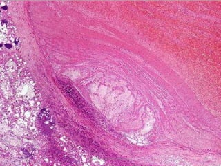 Jesús A. Custodio Marroquín 