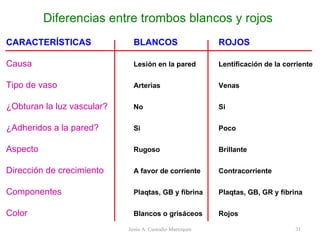 Diferencias entre trombos blancos y rojos CARACTERÍSTICAS BLANCOS ROJOS Causa Lesión en la pared Lentificación de la corriente Tipo de vaso Arterias Venas ¿Obturan la luz vascular? No Si ¿Adheridos a la pared? Si Poco Aspecto Rugoso Brillante Dirección de crecimiento A favor de corriente Contracorriente Componentes Plaqtas, GB y fibrina Plaqtas, GB, GR y fibrina Color Blancos o grisáceos Rojos Jesús A. Custodio Marroquín 