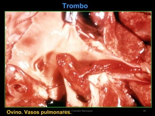 Ovino. Vasos pulmonares.   Trombo Jesús A. Custodio Marroquín 