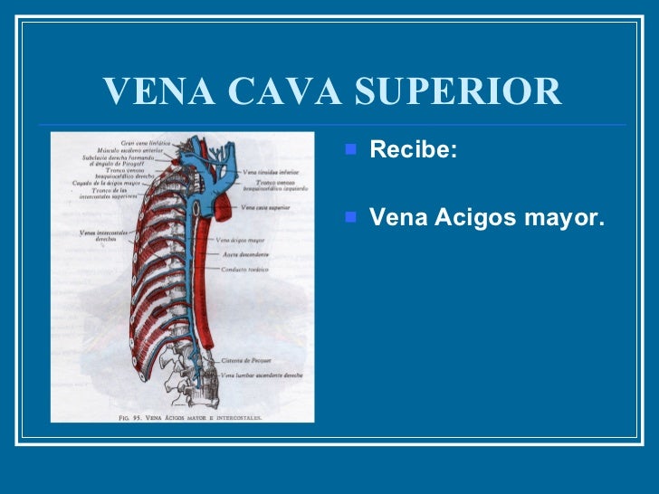 6. Vena Cava Superior