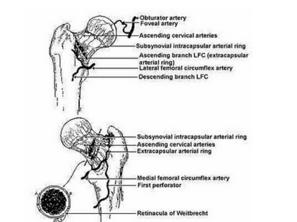 Blood supply of Femoral head and Talus
