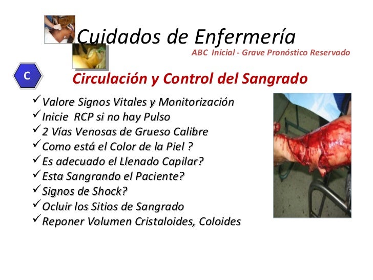 Importancia del equipo de emergencias técnico en