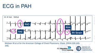 Pah Rhc Comprehensive Diagnosis and Management of Pulmonary Arterial ...