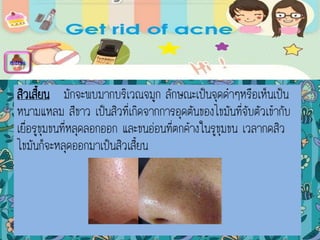 สิวเสี้ยน มักจะพบมากบริเวณจมูก ลักษณะเป็นจุดดาๆหรือเห็นเป็น
หนามแหลม สีขาว เป็นสิวที่เกิดจากการอุดตันของไขมันที่จับตัวเข้ากับ
เยื่อรูขุมขนที่หลุดลอกออก และขนอ่อนที่ตกค้างในรูขุมขน เวลากดสิว
ไขมันก็จะหลุดออกมาเป็นสิวเสี้ยน
menu
 