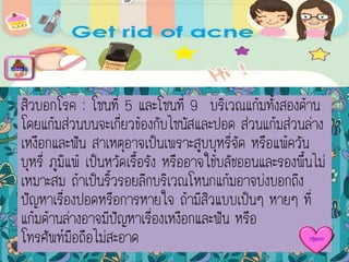 สิวบอกโรค : โซนที่ 5 และโซนที่ 9 บริเวณแก้มทั้งสองด้าน
โดยแก้มส่วนบนจะเกี่ยวข้องกับไซนัสและปอด ส่วนแก้มส่วนล่าง
เหงือกและฟัน สาเหตุอาจเป็นเพราะสูบบุหรี่จัด หรือแพ้ควัน
บุหรี่ ภูมิแพ้ เป็นหวัดเรื้อรัง หรืออาจใช้บลัชออนและรองพื้นไม่
เหมาะสม ถ้าเป็นริ้วรอยลึกบริเวณโหนกแก้มอาจบ่งบอกถึง
ปัญหาเรื่องปอดหรือการหายใจ ถ้ามีสิวแบบเป็นๆ หายๆ ที่
แก้มด้านล่างอาจมีปัญหาเรื่องเหงือกและฟัน หรือ
โทรศัพท์มือถือไม่สะอาด
menu
Again
 