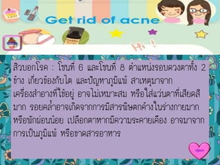 สิวบอกโรค : โซนที่ 6 และโซนที่ 8 ตาแหน่งรอบดวงตาทั้ง 2
ข้าง เกี่ยวข้องกับไต และปัญหาภูมิแพ้ สาเหตุมาจาก
เครื่องสาอางที่ใช้อยู่ อาจไม่เหมาะสม หรือใส่แว่นตาที่เสียดสี
มาก รอยคล้าอาจเกิดจากการมีสารพิษตกค้างในร่างกายมาก
หรือพักผ่อนน้อย เปลือกตาหากมีความระคายเคือง อาจมาจาก
การเป็นภูมิแพ้ หรือขาดสารอาหาร
menu
Again
 