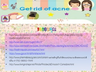 ขอขอบคุณ
• http://www.kondoodee.com/รวมวิธีการรักษาสิว-จาก-Pantip-ง่ายๆ-เห็นผลได้จริงจากกูรู-ผู้มี
ประสบการณ์จริง/146.html
• http://www.dek-d.com/nugirl/33527/
• http://www.siamhealth.net/public_html/Health/Photo_teaching/acne.htm#.VOMCXCkVclI
• http://health.kapook.com/view1637.html
• https://www.gpo.or.th/rdi/html/acne.html
• http://www.pharmabeautycare.com/content- ้ ้ตก ูถ ้หใน ักว ิสทภเะรปกยแามว ิสงอขทภเะรปว ิสนอ ่กงอ
ขไ ้กแ-4-1782-30992-1.html
• http://www.livinginshape.net/Article/Article%20Dr.kosin/1-Comedone.html
menu
 