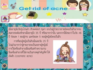 เมื่ออายุพ้นวัยรุ่นไปแล้ว สิวจะค่อยๆ ทุเลา ยกเว้นผู้ป่วยบางรายยังคงเป็นสิวมากจน
สมควรจะต้องรักษาเมื่ออายุถึง 35 ปี หรือมากกว่านั้น นอกจากนี้ยังพบว่าในวัย 40
ปี ร้อยละ 1 ของผู้ชาย และร้อยละ 5 ของผู้หญิงยังคงเป็นสิว
การที่พบผู้หญิงเป็นสิวเมื่อเลยวัย 25 ปี
ไปแล้วมากกว่าผู้ชายอาจจะเป็นเพราะผู้หญิงมี
การใช้เครื่องสาอางเพื่อเสริมสร้างความงาม
ซึ่งเครื่องสาอางที่ใช้อาจเป็นสาเหตุสาคัญที่ทาให้
เกิดสิว (cosmetic acne)
menu
 