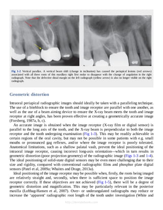 Cone Beam Computed Tomography in Endodontics 1º Edición Edition Shanon ...