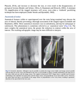 Cone Beam Computed Tomography in Endodontics 1º Edición Edition Shanon ...