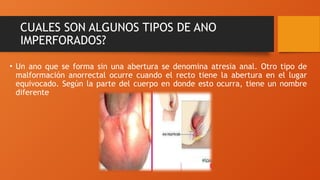 CUALES SON ALGUNOS TIPOS DE ANO
IMPERFORADOS?
• Un ano que se forma sin una abertura se denomina atresia anal. Otro tipo de
malformación anorrectal ocurre cuando el recto tiene la abertura en el lugar
equivocado. Según la parte del cuerpo en donde esto ocurra, tiene un nombre
diferente
 