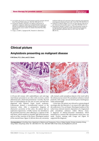 479
71 Lee SJ, Kim HS, Yu R, et al. Novel prostate-specific promoter derived
from PSA and PSMA enhancers. Mol Ther 2002; 6: 415–21.
72 Freytag SO, Paielli D, Wing M, et al. Efficacy and toxicity of
replication-competent adenovirus-mediated double suicide gene
therapy in combination with radiation therapy in an orthotopic
mouse prostate cancer model. Int J Radiat Oncol Biol Phys 2002;
54: 873–85.
73 Yang C, Cirielli C, Capogrossi MC, Passaniti A. Adenovirus-
mediated wild-type p53 expression induces apoptosis and suppresses
tumorigenesis of prostatic tumor cells. Cancer Res 1995; 55: 4210–13.
74 Eastham JA, Hall SJ, Sehgal I, et al. In vivo gene therapy with p53 or
p21 adenovirus for prostate cancer. Cancer Res 1995; 55: 5151–55.
75 Nakanishi H, Mazda O, Satoh E, et al. Nonviral genetic transfer of
Fas ligand induced significant growth suppression and apoptotic
tumor cell death in prostate cancer in vivo. Gene Ther 2003;
10: 434–42.
ReviewGene therapy for prostate cancer
Oncology Vol 5 August 2004 http://oncology.thelancet.com
Clinical picture
A 69-year-old woman with nephrolithiasis and end-stage
renal disease presented at our clinic with recurrent, central
abdominal pain, which had persisted for 3 months. She had
been on haemodialysis for the past 10 years and had been
diagnosed with bilateral carpal tunnel syndrome.
Colonoscopy showed a circumferential tumour at the
transverse colon. After a preoperative diagnosis of
obstructive carcinoma of the colon, the patient had an
exploratory laparotomy. A bulky tumour was identified in
the proximal transverse colon adhering to a segment of the
mid-ileum, which needed an extended right hemicolectomy
and an en bloc resection of the ileum. Histological analysis
of the resected tissue (figure A) did not show any carcinoma
cells; instead, a pink amorphous deposit at the vessel wall in
the submucosa was noted. The amorphous substance stained
positively with Congo red and showed green birefringence
under polarised light.
3 years later, the patient was referred to a gynaecological
oncologist after she detected a 2-cm mass in her right vulva;
she underwent a Tru-cut biopsy. Histological analysis of the
vulval tissue showed extensive deposition of a fragmented
pink amorphous substance within fibrous tissue.
A diagnosis of dialysis-associated amyloidosis, which
manifested as a tumour-like subcutaneous vulval mass, was
made. Positive staining with Congo red (figure B)
supported this diagnosis.
Amyloidosis presenting as malignant disease
K M Chow, P C L Choi, and C C Szeto
Correspondence: Dr Kai Ming Chow, Department of Medicine and Therapeutics, Prince of Wales Hospital, Chinese University of Hong
Kong, Shatin, Hong Kong, China. Tel: +852 2632 3131. Fax: +852 2637 5396. Email: Chow_Kai_Ming@alumni.cuhk.net
 