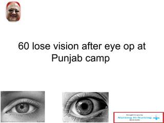 60 lose vision after eye op at 
Punjab camp 
 