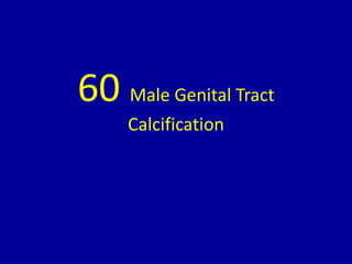 60 Male Genital Tract
Calcification
 