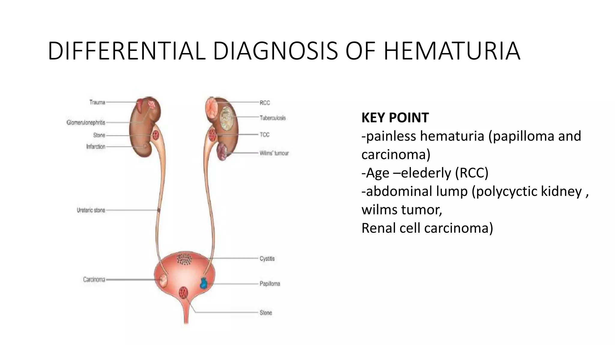 Renal cell carcinoma | PPTX
