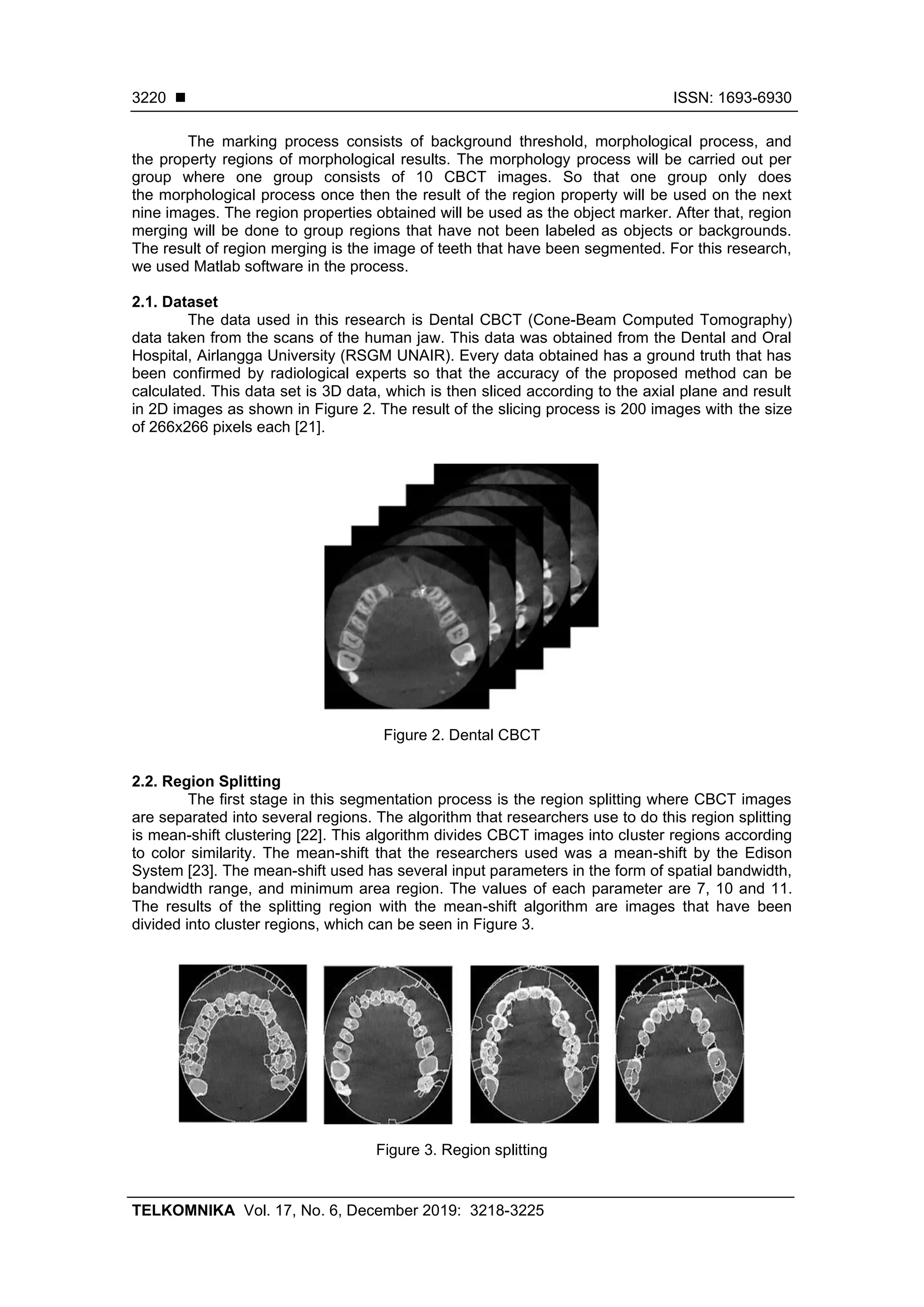 ◼ ISSN: 1693-6930
TELKOMNIKA Vol. 17, No. 6, December 2019: 3218-3225
3220
The marking process consists of background threshold, morphological process, and
the property regions of morphological results. The morphology process will be carried out per
group where one group consists of 10 CBCT images. So that one group only does
the morphological process once then the result of the region property will be used on the next
nine images. The region properties obtained will be used as the object marker. After that, region
merging will be done to group regions that have not been labeled as objects or backgrounds.
The result of region merging is the image of teeth that have been segmented. For this research,
we used Matlab software in the process.
2.1. Dataset
The data used in this research is Dental CBCT (Cone-Beam Computed Tomography)
data taken from the scans of the human jaw. This data was obtained from the Dental and Oral
Hospital, Airlangga University (RSGM UNAIR). Every data obtained has a ground truth that has
been confirmed by radiological experts so that the accuracy of the proposed method can be
calculated. This data set is 3D data, which is then sliced according to the axial plane and result
in 2D images as shown in Figure 2. The result of the slicing process is 200 images with the size
of 266x266 pixels each [21].
Figure 2. Dental CBCT
2.2. Region Splitting
The first stage in this segmentation process is the region splitting where CBCT images
are separated into several regions. The algorithm that researchers use to do this region splitting
is mean-shift clustering [22]. This algorithm divides CBCT images into cluster regions according
to color similarity. The mean-shift that the researchers used was a mean-shift by the Edison
System [23]. The mean-shift used has several input parameters in the form of spatial bandwidth,
bandwidth range, and minimum area region. The values of each parameter are 7, 10 and 11.
The results of the splitting region with the mean-shift algorithm are images that have been
divided into cluster regions, which can be seen in Figure 3.
Figure 3. Region splitting
 