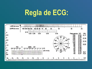 Regla de ECG:
 