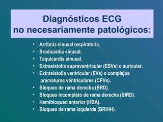 Diagnósticos ECG
no necesariamente patológicos:
• Arritmia sinusal respiratoria.
• Bradicardia sinusal.
• Taquicardia sinusal.
• Extrasistolia supraventricular (ESVs) o auricular.
• Extrasistolia ventricular (EVs) o complejos
prematuros ventriculares (CPVs).
• Bloqueo de rama derecha (BRD).
• Bloqueo incompleto de rama derecha (BIRD).
• Hemibloqueo anterior (HBA).
• Bloqueo de rama izquierda (BRIHH).
 