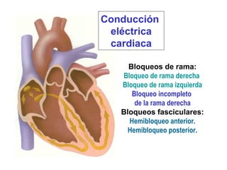 Conducción 
eléctrica
cardiaca
Bloqueos de rama:
Bloqueo de rama derecha
Bloqueo de rama izquierda
Bloqueo incompleto
de la rama derecha
Bloqueos fasciculares:
Hemibloqueo anterior.
Hemibloqueo posterior.
 