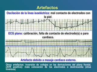 Otros artefactos: inversión de voltajes en las derivaciones del plano frontal,
(AVR positiva): mala colocación de los electrodos o dextrocardia (situs
inversus)
Artefactos
Oscilación de la línea isoeléctrica: mal contacto de electrodos con
la piel.
ECG plano: calibración, falta de contacto de electrodo(s) o paro
cardiaco.
Artefacto debido a masaje cardiaco externo.
 