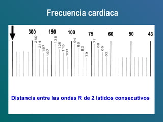 Frecuencia cardiaca
50 436075100150300
Distancia entre las ondas R de 2 latidos consecutivos
 