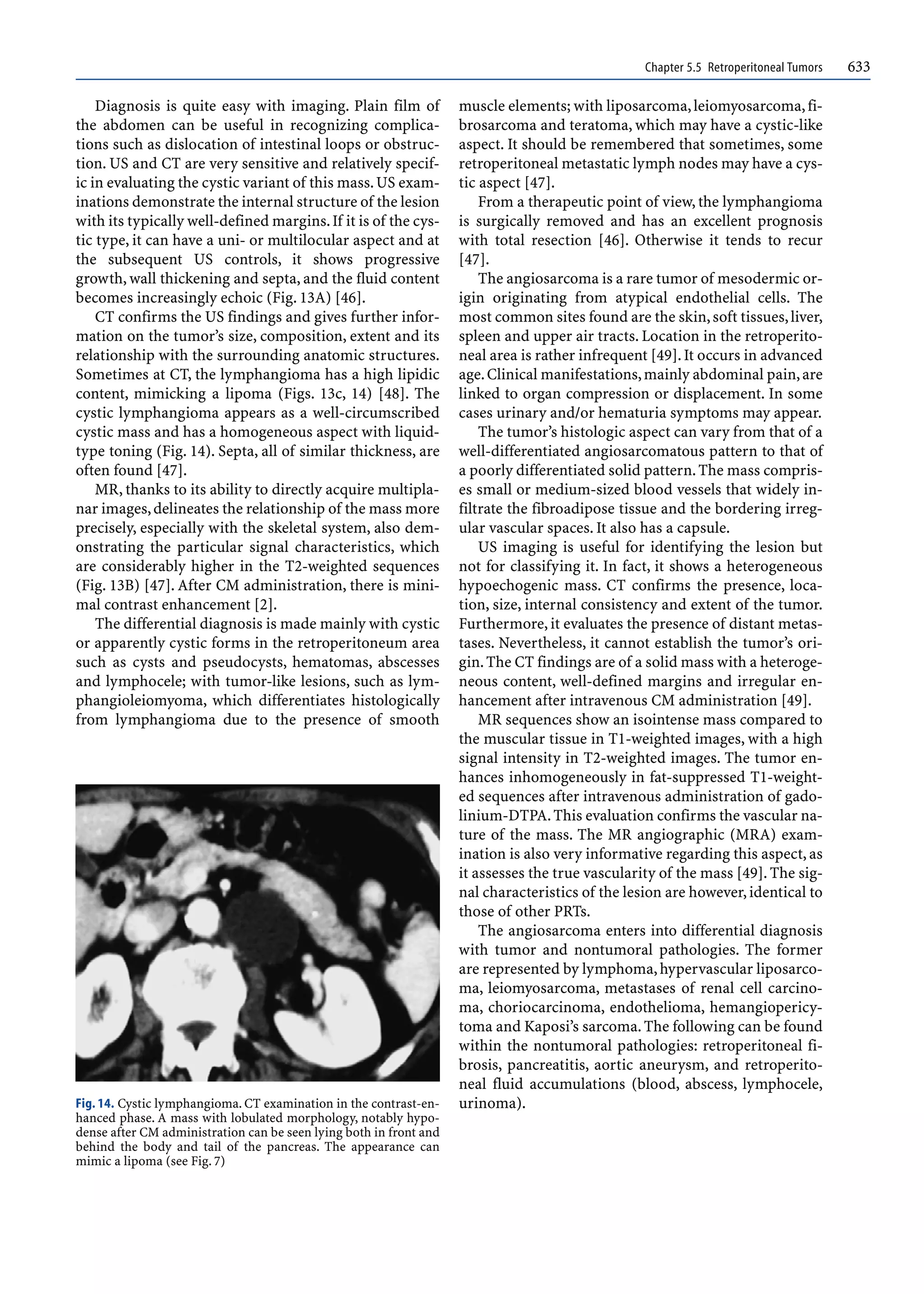 Chapter 5.5 Retroperitoneal Tumors 633
Diagnosis is quite easy with imaging. Plain film of
the abdomen can be useful in recognizing complica-
tions such as dislocation of intestinal loops or obstruc-
tion. US and CT are very sensitive and relatively specif-
ic in evaluating the cystic variant of this mass.US exam-
inations demonstrate the internal structure of the lesion
with its typically well-defined margins.If it is of the cys-
tic type, it can have a uni- or multilocular aspect and at
the subsequent US controls, it shows progressive
growth, wall thickening and septa, and the fluid content
becomes increasingly echoic (Fig. 13A) [46].
CT confirms the US findings and gives further infor-
mation on the tumor’s size, composition, extent and its
relationship with the surrounding anatomic structures.
Sometimes at CT, the lymphangioma has a high lipidic
content, mimicking a lipoma (Figs. 13c, 14) [48]. The
cystic lymphangioma appears as a well-circumscribed
cystic mass and has a homogeneous aspect with liquid-
type toning (Fig. 14). Septa, all of similar thickness, are
often found [47].
MR, thanks to its ability to directly acquire multipla-
nar images,delineates the relationship of the mass more
precisely, especially with the skeletal system, also dem-
onstrating the particular signal characteristics, which
are considerably higher in the T2-weighted sequences
(Fig. 13B) [47]. After CM administration, there is mini-
mal contrast enhancement [2].
The differential diagnosis is made mainly with cystic
or apparently cystic forms in the retroperitoneum area
such as cysts and pseudocysts, hematomas, abscesses
and lymphocele; with tumor-like lesions, such as lym-
phangioleiomyoma, which differentiates histologically
from lymphangioma due to the presence of smooth
muscle elements; with liposarcoma,leiomyosarcoma,fi-
brosarcoma and teratoma, which may have a cystic-like
aspect. It should be remembered that sometimes, some
retroperitoneal metastatic lymph nodes may have a cys-
tic aspect [47].
From a therapeutic point of view, the lymphangioma
is surgically removed and has an excellent prognosis
with total resection [46]. Otherwise it tends to recur
[47].
The angiosarcoma is a rare tumor of mesodermic or-
igin originating from atypical endothelial cells. The
most common sites found are the skin,soft tissues,liver,
spleen and upper air tracts. Location in the retroperito-
neal area is rather infrequent [49].It occurs in advanced
age.Clinical manifestations,mainly abdominal pain,are
linked to organ compression or displacement. In some
cases urinary and/or hematuria symptoms may appear.
The tumor’s histologic aspect can vary from that of a
well-differentiated angiosarcomatous pattern to that of
a poorly differentiated solid pattern.The mass compris-
es small or medium-sized blood vessels that widely in-
filtrate the fibroadipose tissue and the bordering irreg-
ular vascular spaces. It also has a capsule.
US imaging is useful for identifying the lesion but
not for classifying it. In fact, it shows a heterogeneous
hypoechogenic mass. CT confirms the presence, loca-
tion, size, internal consistency and extent of the tumor.
Furthermore, it evaluates the presence of distant metas-
tases. Nevertheless, it cannot establish the tumor’s ori-
gin.The CT findings are of a solid mass with a heteroge-
neous content, well-defined margins and irregular en-
hancement after intravenous CM administration [49].
MR sequences show an isointense mass compared to
the muscular tissue in T1-weighted images, with a high
signal intensity in T2-weighted images. The tumor en-
hances inhomogeneously in fat-suppressed T1-weight-
ed sequences after intravenous administration of gado-
linium-DTPA.This evaluation confirms the vascular na-
ture of the mass. The MR angiographic (MRA) exam-
ination is also very informative regarding this aspect, as
it assesses the true vascularity of the mass [49]. The sig-
nal characteristics of the lesion are however,identical to
those of other PRTs.
The angiosarcoma enters into differential diagnosis
with tumor and nontumoral pathologies. The former
are represented by lymphoma,hypervascular liposarco-
ma, leiomyosarcoma, metastases of renal cell carcino-
ma, choriocarcinoma, endothelioma, hemangiopericy-
toma and Kaposi’s sarcoma.The following can be found
within the nontumoral pathologies: retroperitoneal fi-
brosis, pancreatitis, aortic aneurysm, and retroperito-
neal fluid accumulations (blood, abscess, lymphocele,
urinoma).
Fig. 14. Cystic lymphangioma. CT examination in the contrast-en-
hanced phase. A mass with lobulated morphology, notably hypo-
dense after CM administration can be seen lying both in front and
behind the body and tail of the pancreas. The appearance can
mimic a lipoma (see Fig. 7)
 