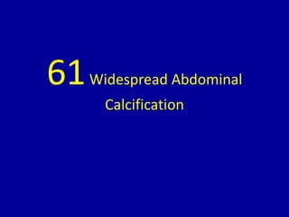 61Widespread Abdominal
Calcification
 