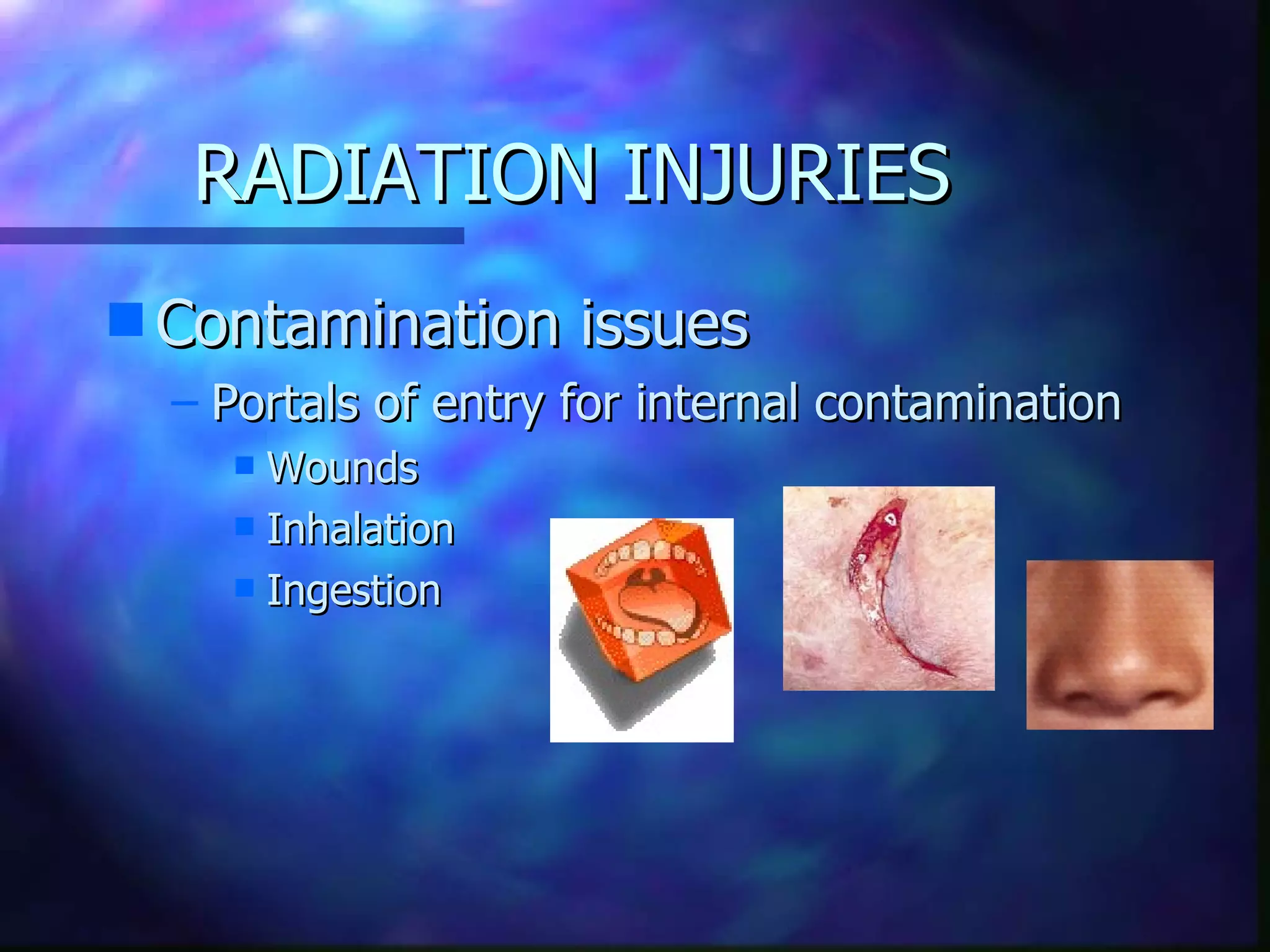 radiation injury PPT