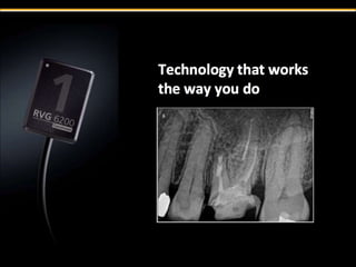 RVG 6200 High Definition Digital Xray Sensor from Carestream Dental | PPTX