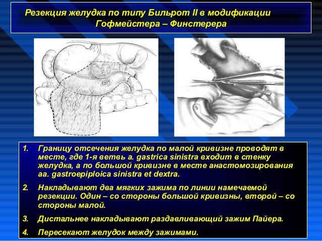 Операция 6