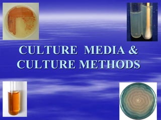 CULTURE MEDIA &
CULTURE METHODS
 
