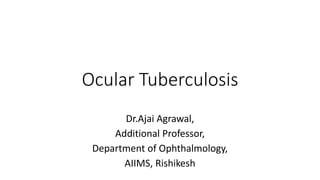 Ocular Tuberculosis
Dr.Ajai Agrawal,
Additional Professor,
Department of Ophthalmology,
AIIMS, Rishikesh
 