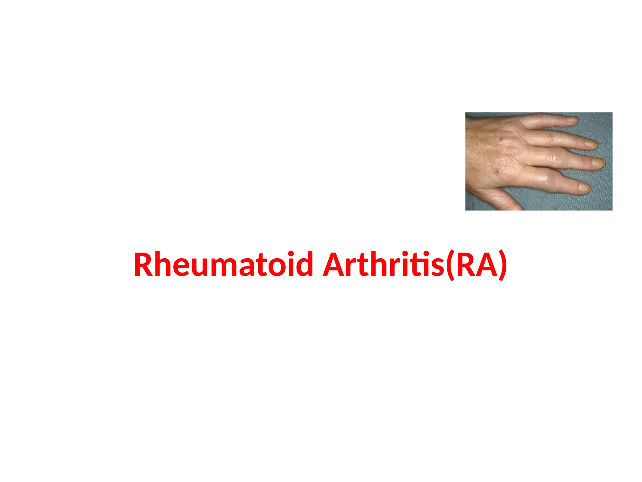Rheumatoid arthritis definition pathophysiology pptx bone and