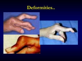 Deformities..
 